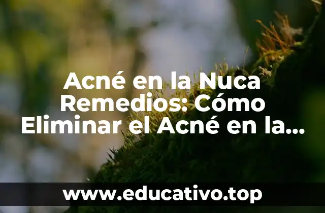 Acné en la Nuca Remedios: Cómo Eliminar el Acné en la Parte Posterior de la Cabeza