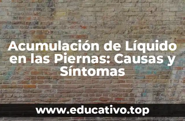 Acumulación de Líquido en las Piernas: Causas y Síntomas