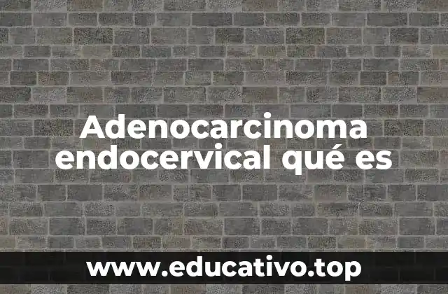 Adenocarcinoma endocervical qué es