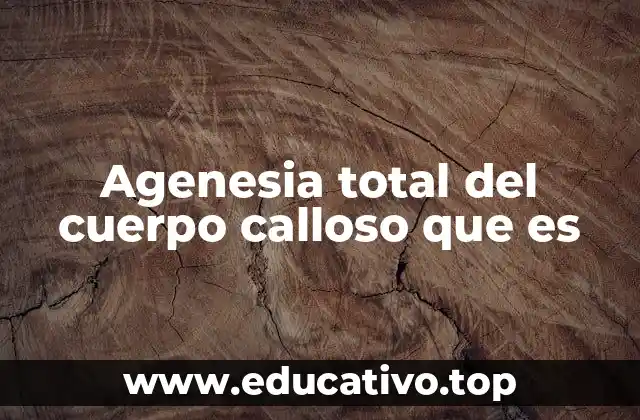 Agenesia total del cuerpo calloso que es