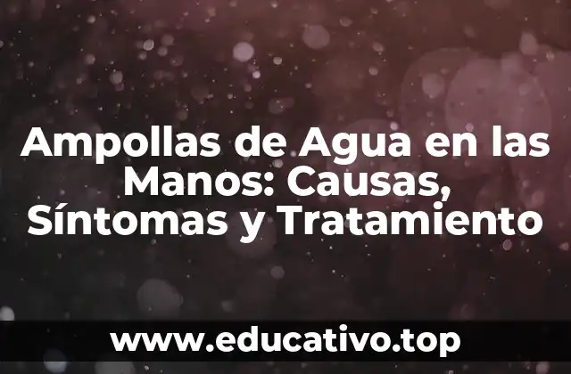 Ampollas de Agua en las Manos: Causas, Síntomas y Tratamiento