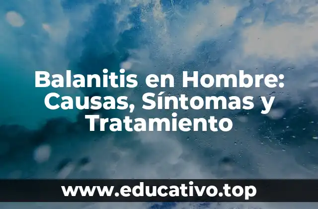 Balanitis en Hombre: Causas, Síntomas y Tratamiento