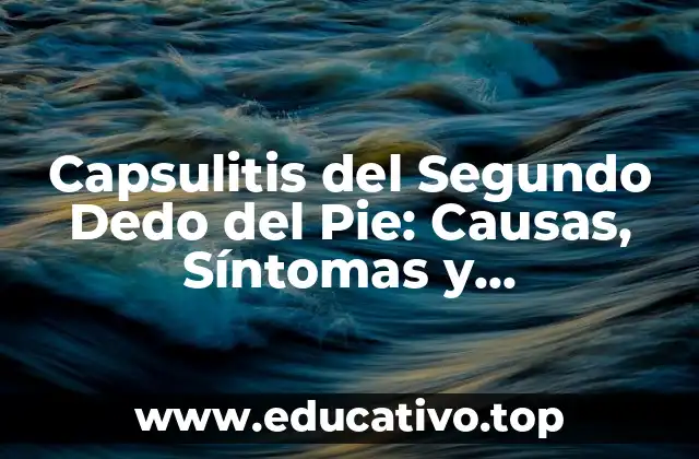 Capsulitis del Segundo Dedo del Pie: Causas, Síntomas y Tratamientos