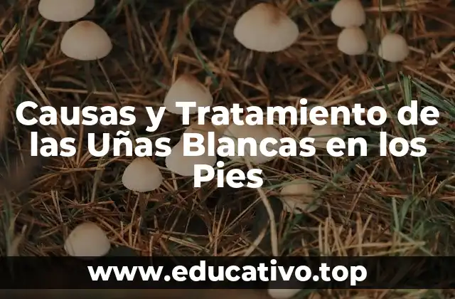 Causas y Tratamiento de las Uñas Blancas en los Pies