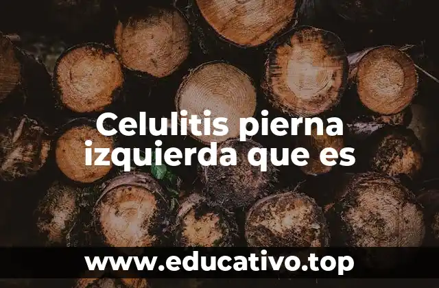 Celulitis pierna izquierda que es