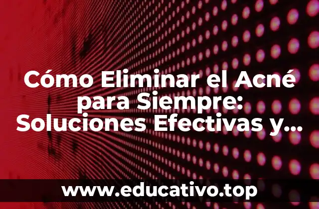 Cómo Eliminar el Acné para Siempre: Soluciones Efectivas y Permanentes