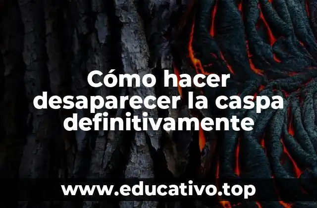 Cómo hacer desaparecer la caspa definitivamente