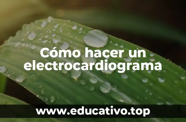 Electrocardiograma