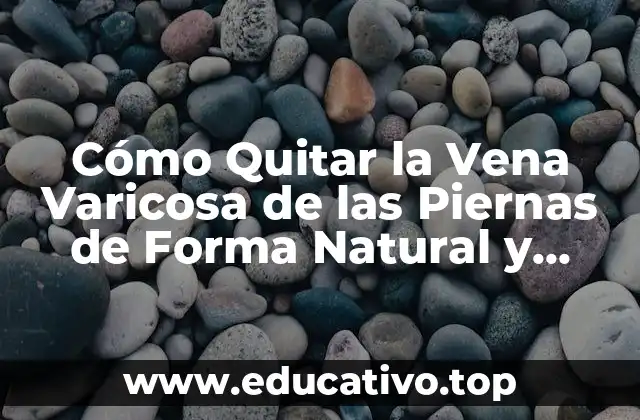 Cómo Quitar la Vena Varicosa de las Piernas de Forma Natural y Eficaz
