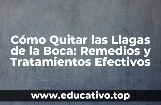 Cómo Quitar las Llagas de la Boca: Remedios y Tratamientos Efectivos