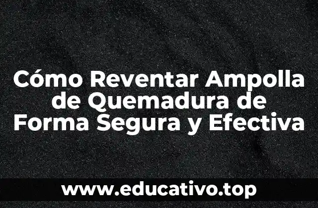 Cómo Reventar Ampolla de Quemadura de Forma Segura y Efectiva