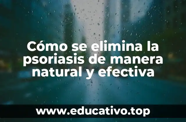 Cómo se elimina la psoriasis de manera natural y efectiva