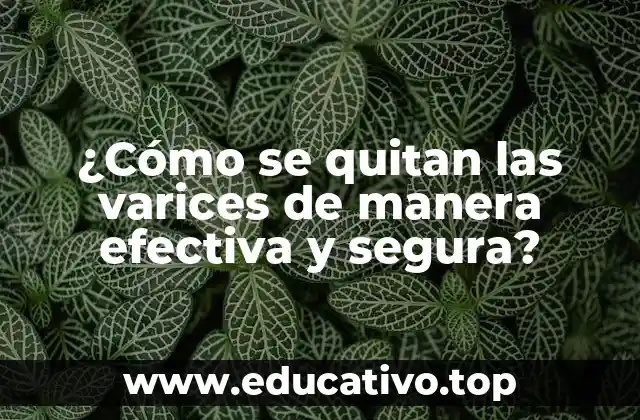 ¿Cómo se quitan las varices de manera efectiva y segura?