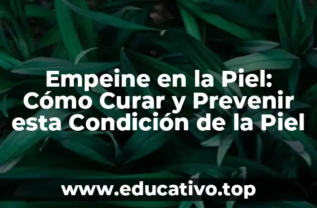 Empeine en la Piel: Cómo Curar y Prevenir esta Condición de la Piel