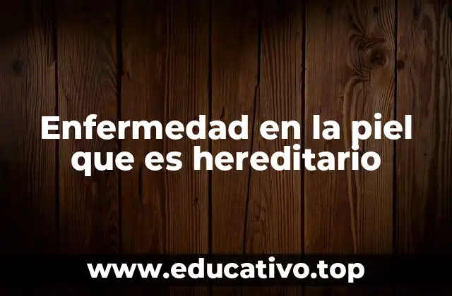 Enfermedad en la piel que es hereditario