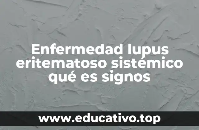Enfermedad lupus eritematoso sistémico qué es signos