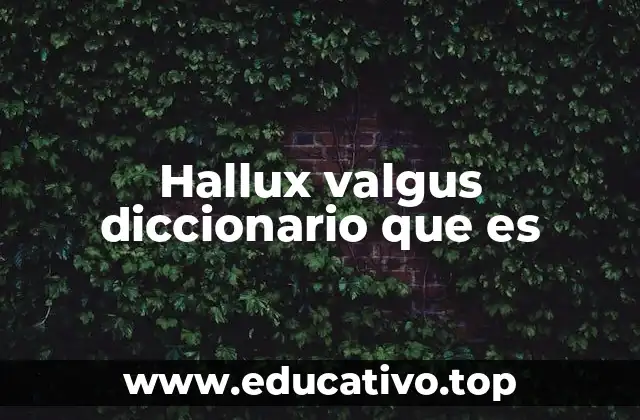 Hallux valgus diccionario que es