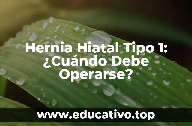 Hernia Hiatal Tipo 1: ¿Cuándo Debe Operarse?