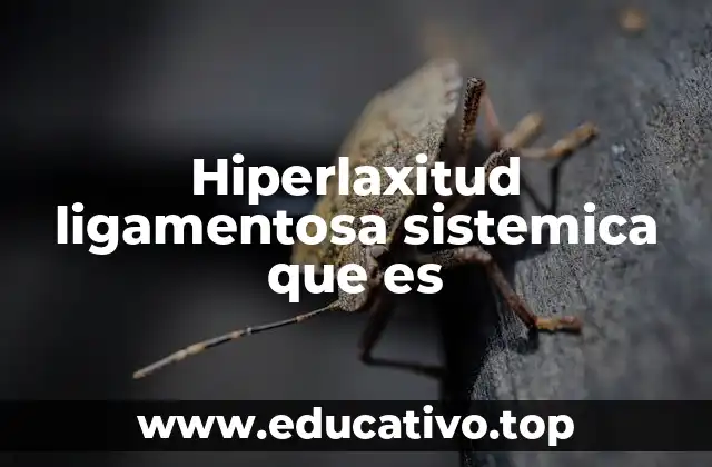 Hiperlaxitud ligamentosa sistemica que es