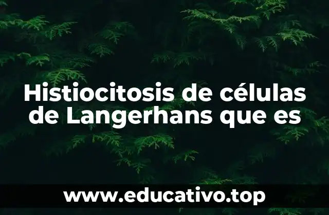 Histiocitosis de células de Langerhans que es