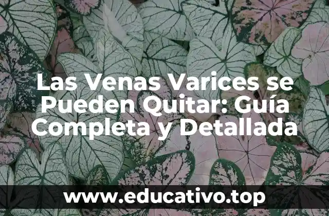 Las Venas Varices se Pueden Quitar: Guía Completa y Detallada