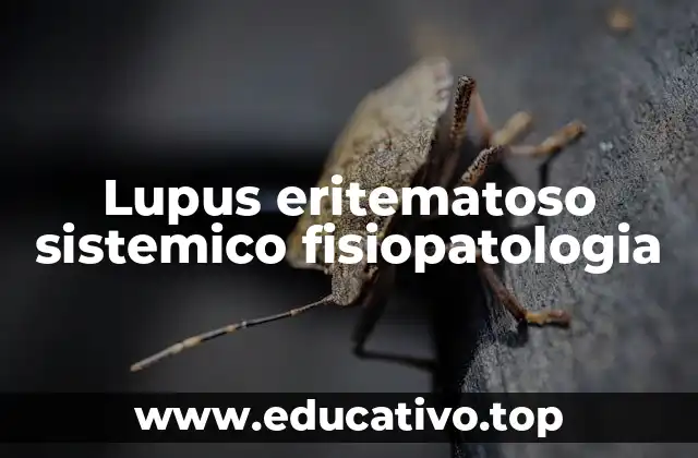 Lupus eritematoso sistemico fisiopatologia