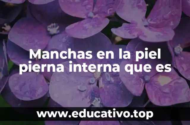Manchas en la piel pierna interna que es
