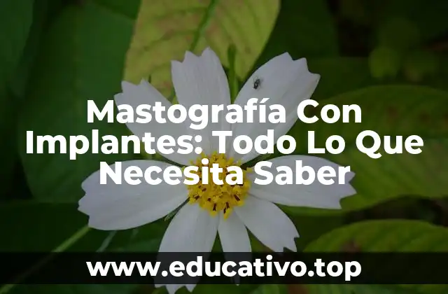Mastografía Con Implantes: Todo Lo Que Necesita Saber