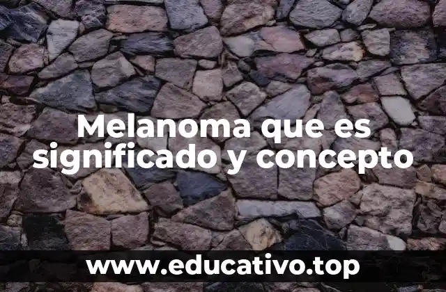 Melanoma que es significado y concepto