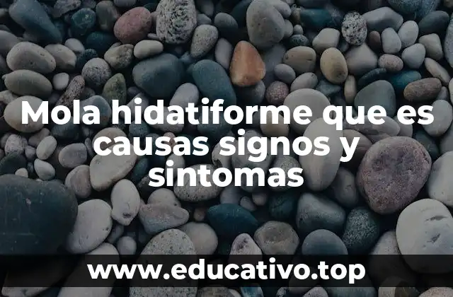 Mola hidatiforme que es causas signos y sintomas