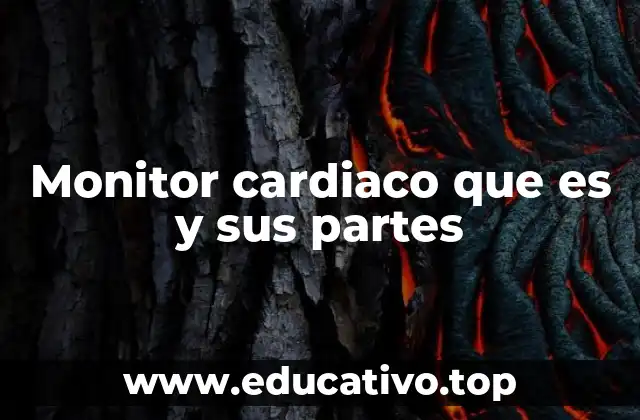 Monitor cardiaco que es y sus partes
