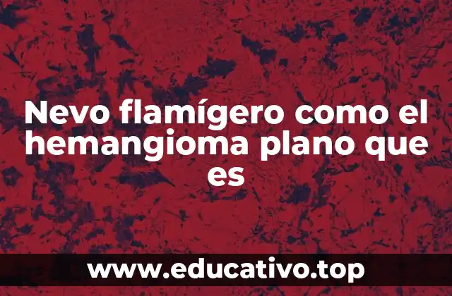 Nevo flamígero como el hemangioma plano que es