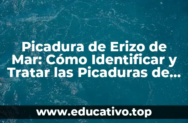Picadura de Erizo de Mar: Cómo Identificar y Tratar las Picaduras de Estos Animales Marinos