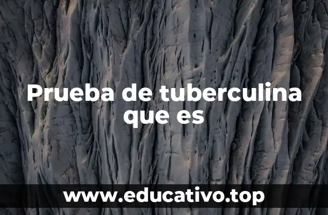 Prueba de tuberculina que es