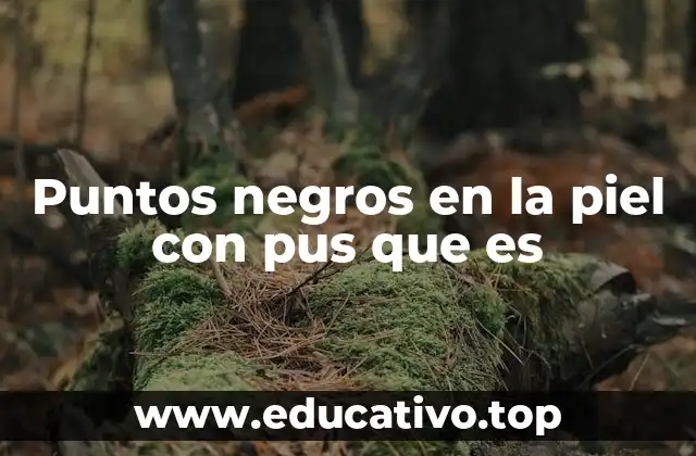 Puntos negros en la piel con pus que es