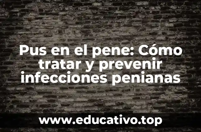Pus en el pene: Cómo tratar y prevenir infecciones penianas