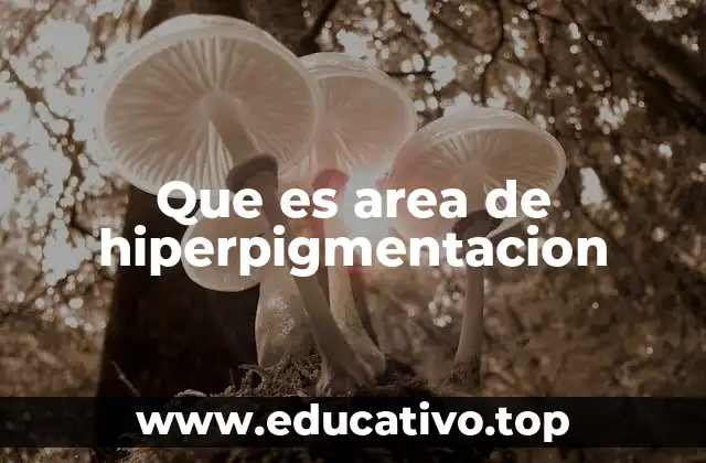Que es area de hiperpigmentacion