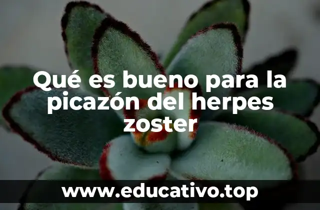 Qué es bueno para la picazón del herpes zoster