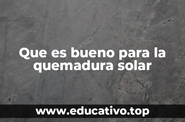 Que es bueno para la quemadura solar