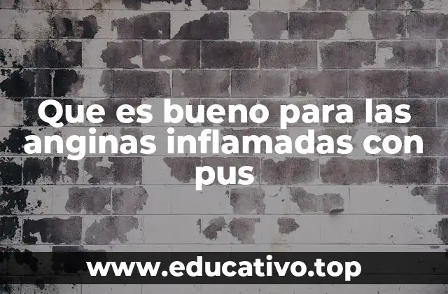 Que es bueno para las anginas inflamadas con pus