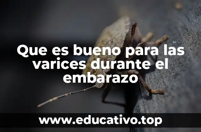 Cómo prevenir las varices durante la gestación