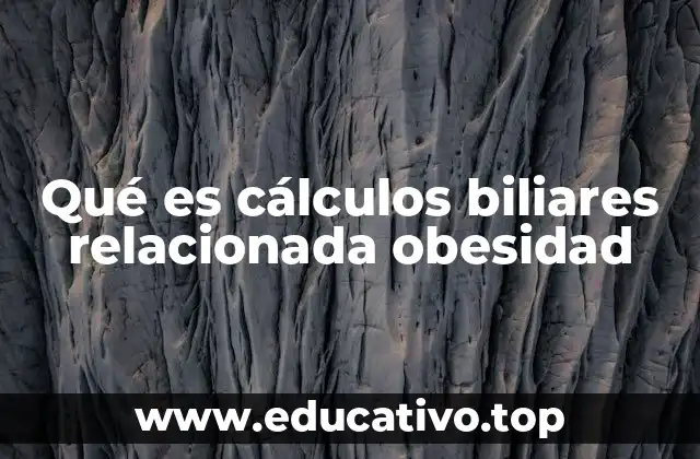 Qué es cálculos biliares relacionada obesidad