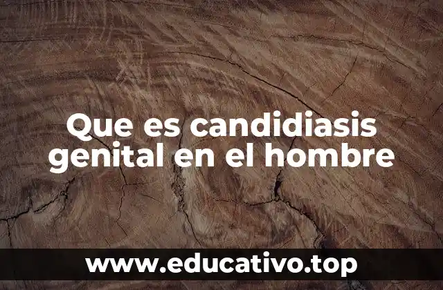 Causas y factores de riesgo de la infección fúngica en hombres