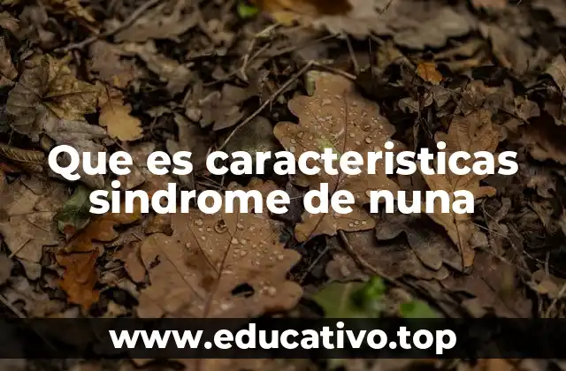 Que es caracteristicas sindrome de nuna