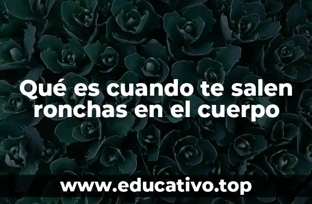 Qué es cuando te salen ronchas en el cuerpo