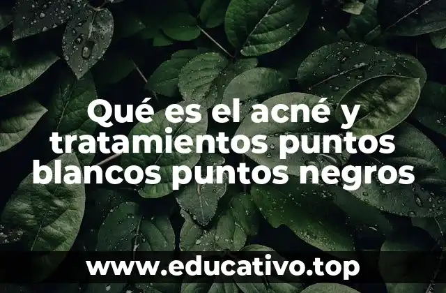 Qué es el acné y tratamientos puntos blancos puntos negros