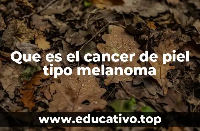 Que es el cancer de piel tipo melanoma