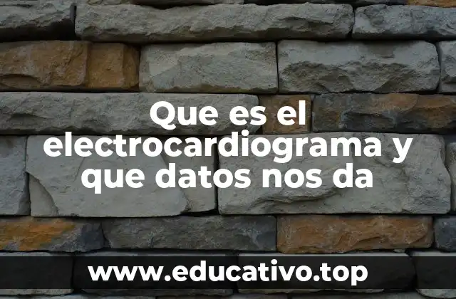 Que es el electrocardiograma y que datos nos da