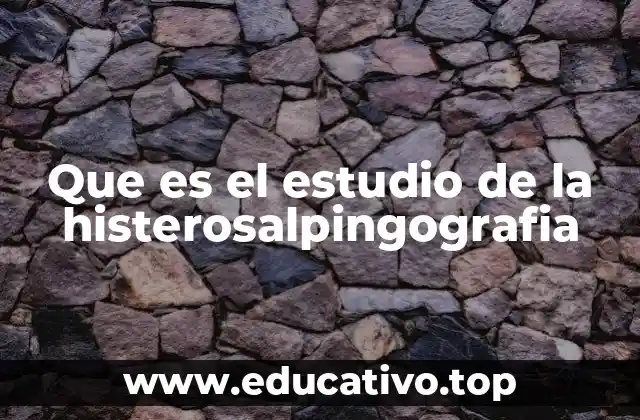 Que es el estudio de la histerosalpingografia