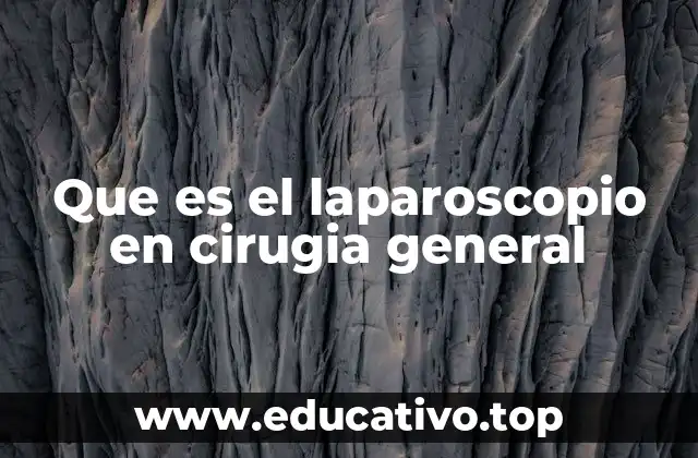 Que es el laparoscopio en cirugia general
